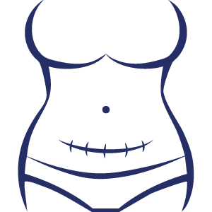 Previjanje i nega rane